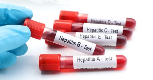LLL16817377331295985694.jpeg