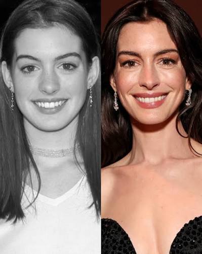 ANNNEHATHAWAY.jpeg